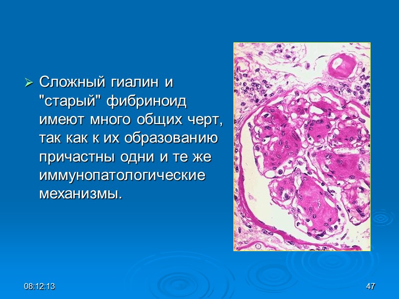 Сложный гиалин и 